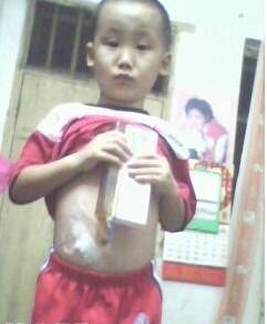 ÿ�����ϣ����ڼ����8-12Сʱ�������롣�����ڶ��ӣ���Ƥ��������СС����׺ۡ�