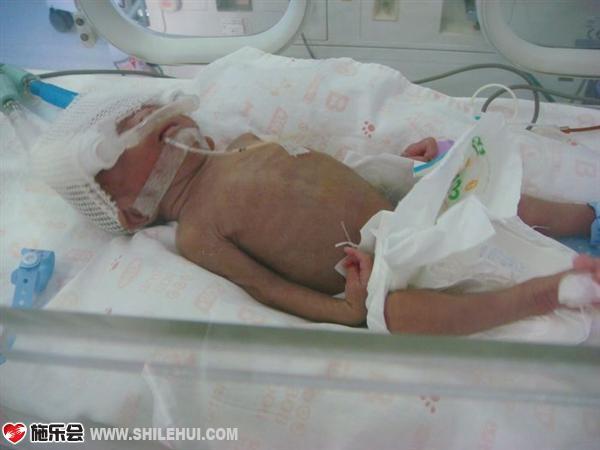 ���ӵ�����ܲ���