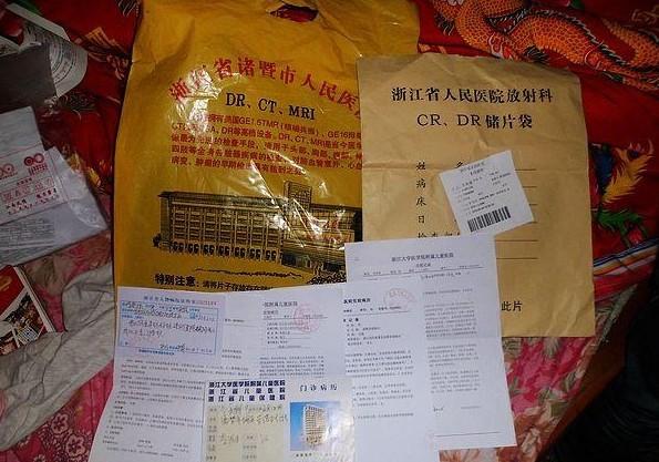 ��Щ����С���ֵľ����¼���ͱ��浥