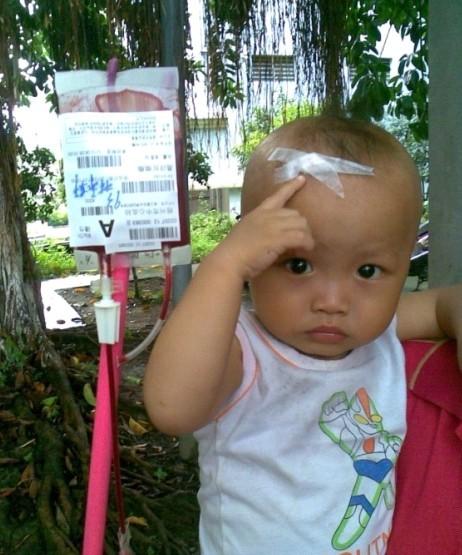 С����ָ����Ѫ���˿ڣ�˵����