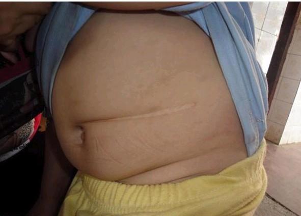 ��÷��������ҽԺ�г�Ƣ���������������ĵ��̣�Լ��18CM��