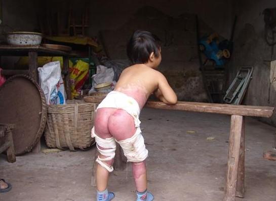 С����ȫ������30%��ƨ��Ҳ��Ⱦ�ˣ�����ֻ��վ�Ų�������������������ʹ�����ۿޡ�