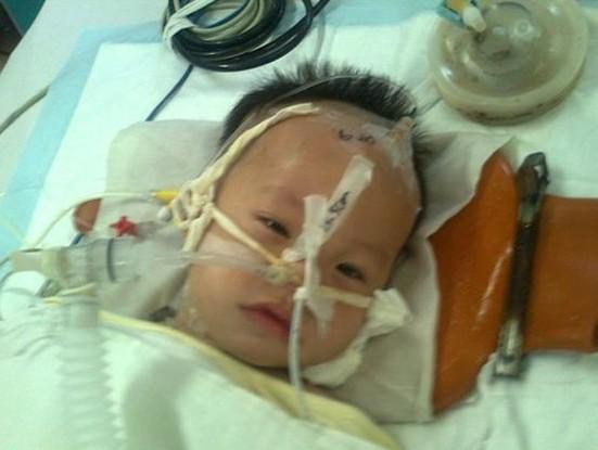 �����ϵı���