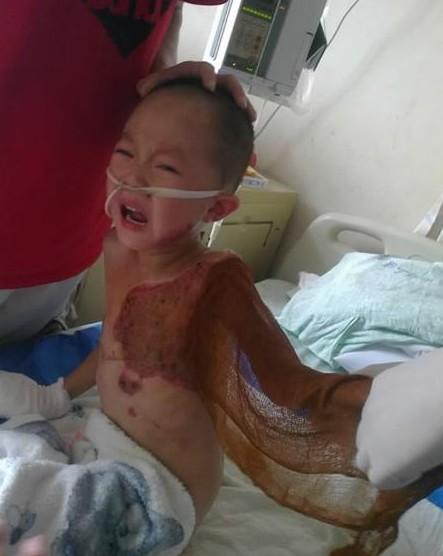 �⺢��һֱ�ܼ�ǿ��ֻ�ڻ�ҩʱ��һ��