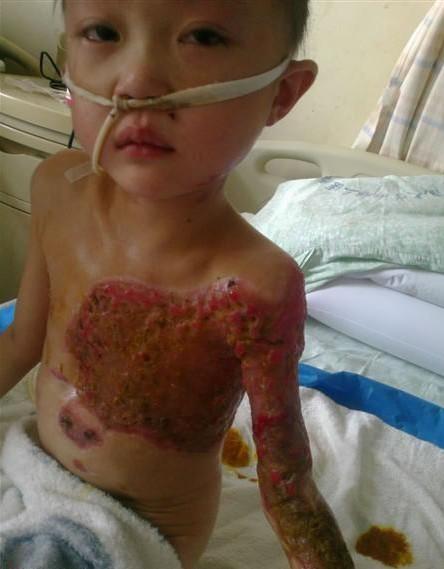 �˺�����