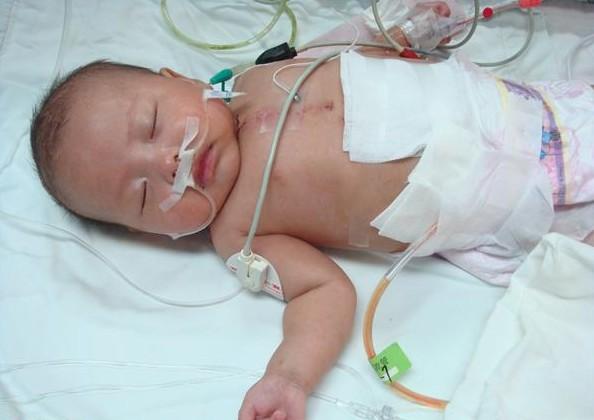 ��������ס��ICU��