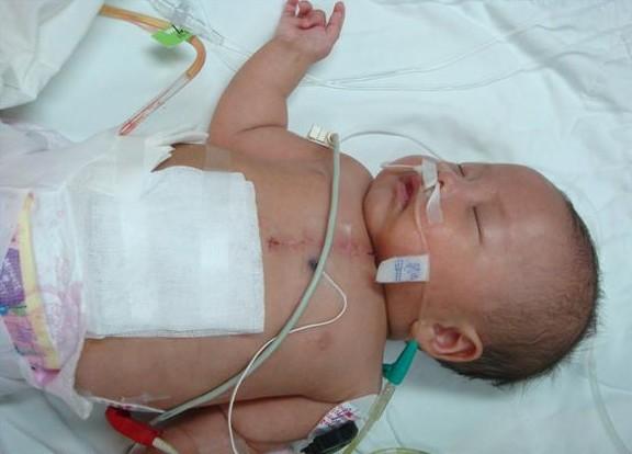 ��ICU�ҽ�������