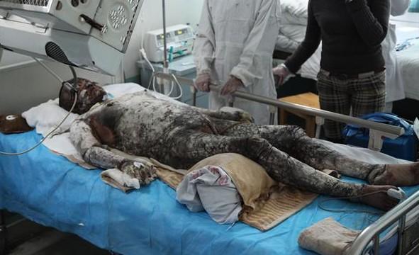 �����Σ�����ѹ�������ҽ��˵���Ժ�������Ҫ�ܶ����