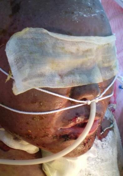 �����ᱻ����ҽԺ���죬ҽ�������߻�û�и��ף��ͰѺ������������������û���һֱ�ú�����ά������