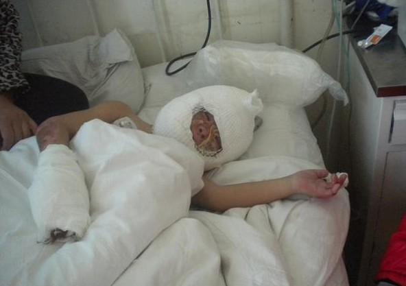 ���ӵ��沿���ؿڸ첲�������أ���ɴ������������������û�취Ϊ�����κú��ӵĲ�