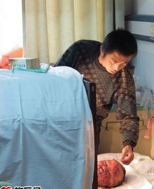 С�γɵĲ����ڰﺢ��Ϳҩ�����ź���˺���ѷεĿ�����ʹ�����ǵ�����