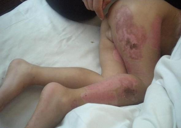 ȡƤ�ĵط��������ĺ����ܶ��ٿడ