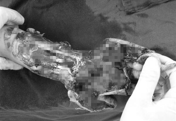 ���ǳ��µ���Ѫ��ģ�����֣�����ȫ�ǲ�м������޴�������