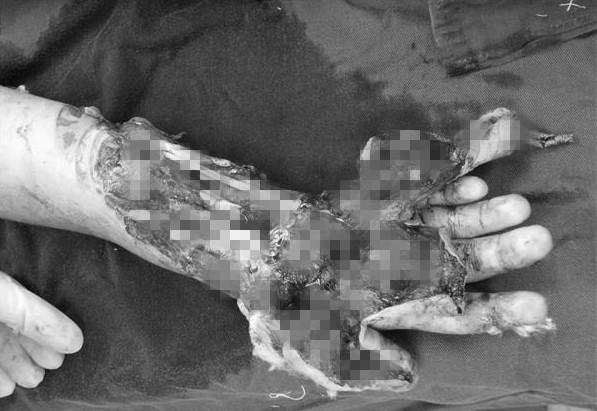 ����Ѫ��ģ�����֣����ǲҲ��̶�