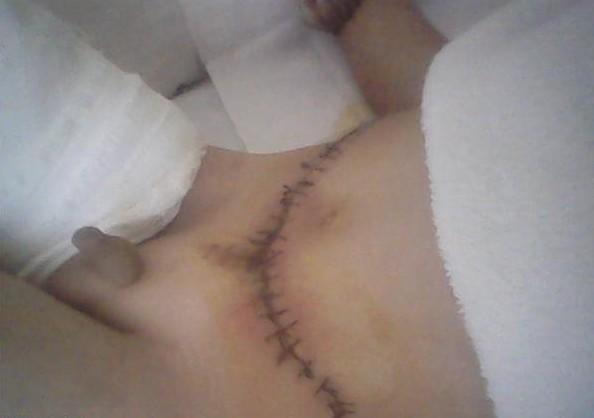 ��������Ƥ���Ķ�Ƥ���Ѿ���Щ����