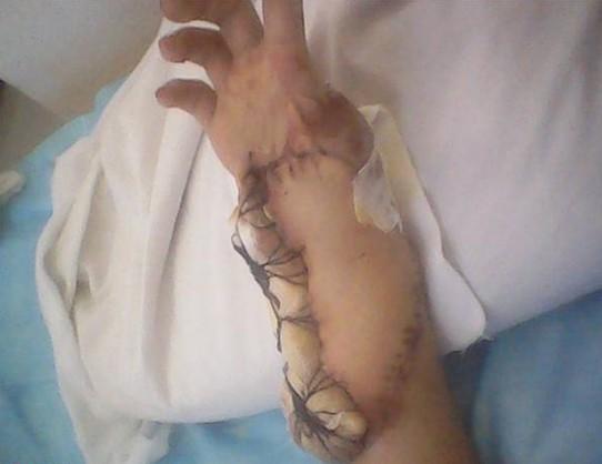 �������