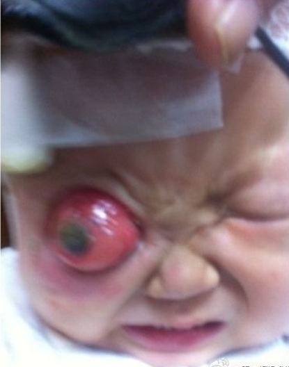 �������ڵ��۲����Ѿ�ͻ������Ҫ����ס��Ⱦ��������ժ����������������������Ժ��Ⱦ�ķ��ջή�ͣ������ܵ�ˮ����ˮʱ�䳤�ˣ�����������˥�ߣ������ô������ķ��մ���Ϊ��Ҫȫ��������