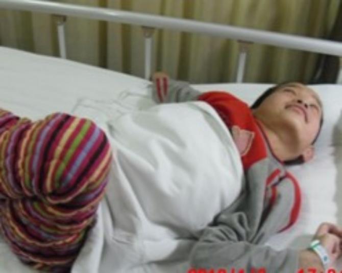 �ֲ��ζ�---֫��Ť�������Ρ����� ��ͬʱ����Ρ�������