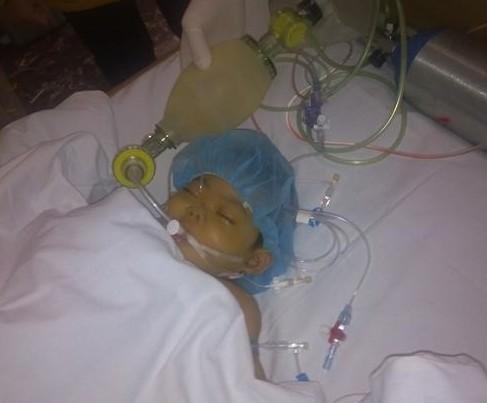 ���������ֲ������������ת��ICU