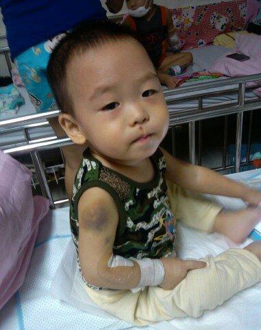 ��ȥҽԺ������ϸ��̫�ͣ�����첲�ϴ��룬һ��ͳ��ֺ���