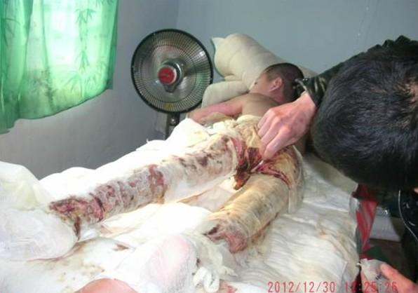 ����Ƿ�Ѻ���תԺ�����������ڻ�������