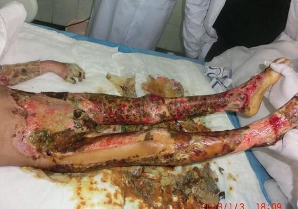 ������֫���������