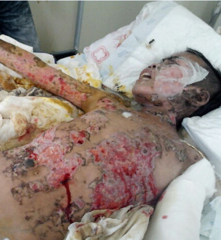 �����������زҲ��̶�