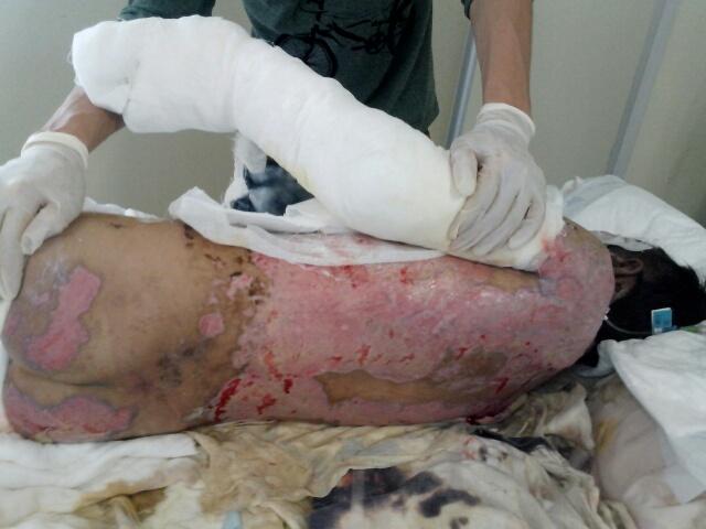 �����������زҲ��̶�