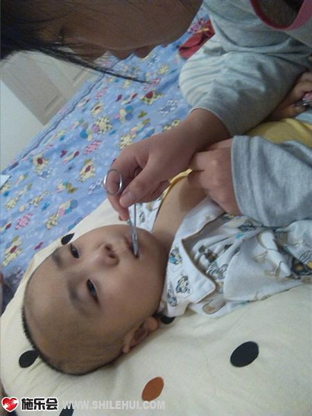 �����С������ӵ����������������ǻ����Ϊ�ϵĻ���ҩ���˺����ӵĿ�ǻճĤ��ÿ�γ��궫��������ֹѪǯ��������������ǻ���Է���ǻ���ã�