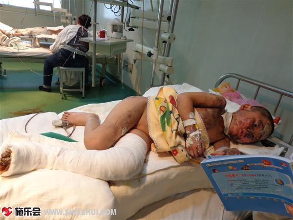 С�������Ѻ���ź��������裬Ϊ�˷�ɢС���ϵ�ע���������������˻�������ʱ����С���ϵ�������