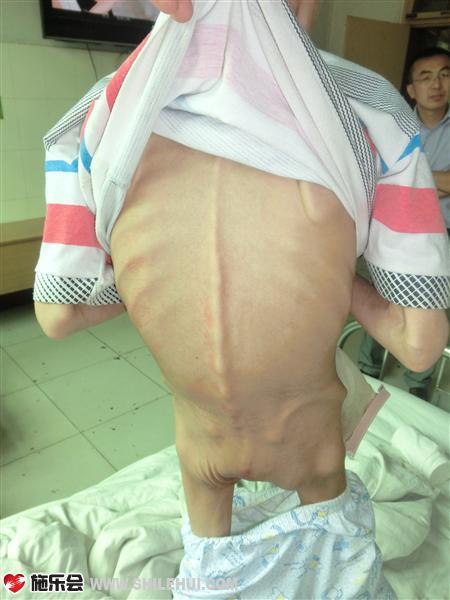 �β��Ѿ�û��˿���ˣ������������һ��Ƥ���ڹ�ͷ��