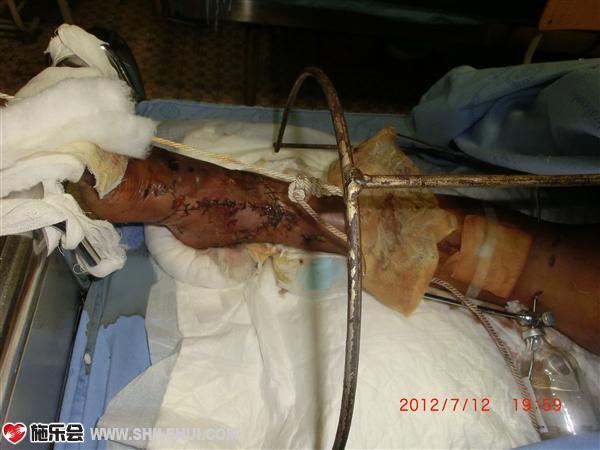 ��ʱ��ֻ�Ǳ�Ƥ��ϣ���ͷ��û�ӣ������������صĲм�����ϣ��վ��������