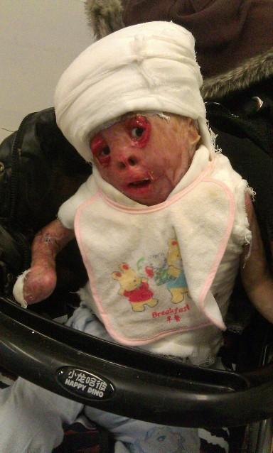 �������˺���Ƭ