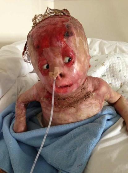 ����סԺ�ڼ�