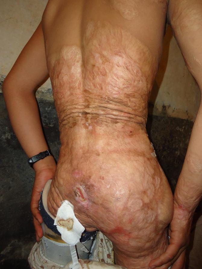 ���������������β���������