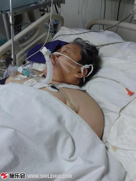 ���������˸�Ⱦ���޷�������ֻ�ܲ�ȡ�������ƣ������ÿ��������ף����ȡ�������ƣ�Ӫ���Ϳ�������һ�ʲ��ƵĿ�֧�������������أ�������������Ҫʯ��ׯ�е�һҽԺ�������֢�໤�ҽ������ƣ�����һ��Ļ�����������3000��Ԫ��