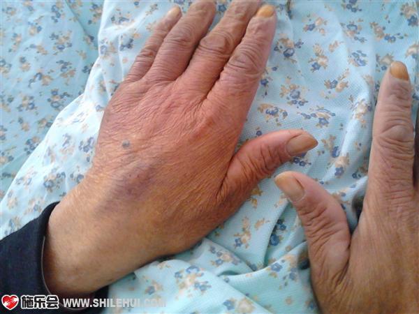 ����������û��ҽ��ǰ��ȫ�����ף����������ҽ�Σ����˺ܶ࣬ͼΪ���Ǹ��׵�˫�֡�