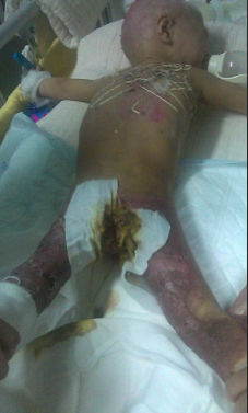 ��������걳��ͷ��ȡƤȫ���������˻�����ֲƤ+�����������