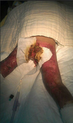 ����껸��������������