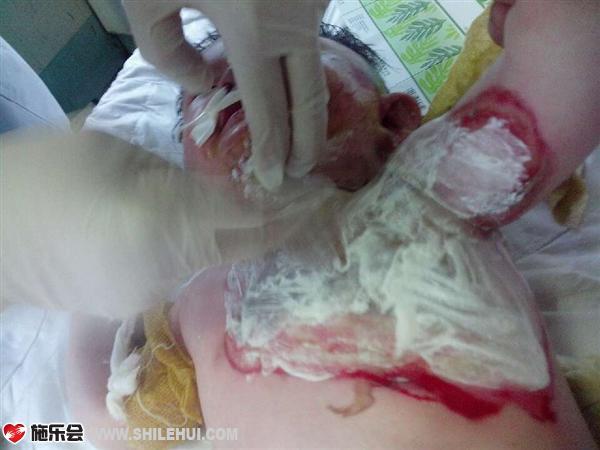 �������ڽ���ʹ�����ɣ����Ǳ����ض����˵��ز������ú���ʹѽ��������ѽ��