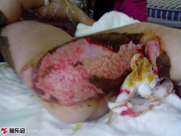 ���ǻ��������˵Ĵ���