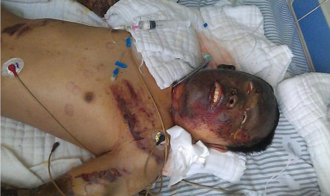 �����˸�����˺�ĺ�������Ŀȫ�ǡ�