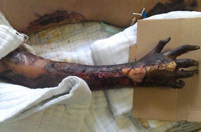 �����˵��ֱۣ������Ѿ��ѿ�������ÿ��ÿ�붼�ڳ�����ʹ��ļ尾��