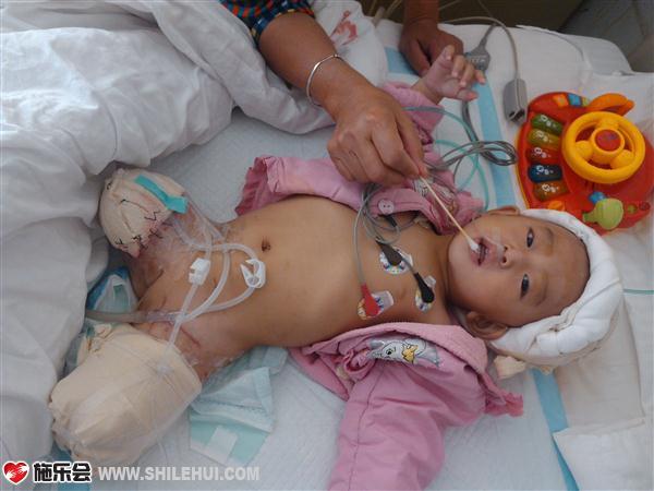 �����һ��ֲƤ������ҽ��˵��Ҫ����Сʱ���ñ���˯�������ñ����Զ��������������Աߣ�һ����һ�εĽ�����Ϊ������ƵƵ�����˯�ı��������ʱ���Ҿ��ã���������������̵��ˣ���һ����Ϊ����������֮����һ��һ���ĺ��ţ���Ҫ����Ҫ�����ѭ����