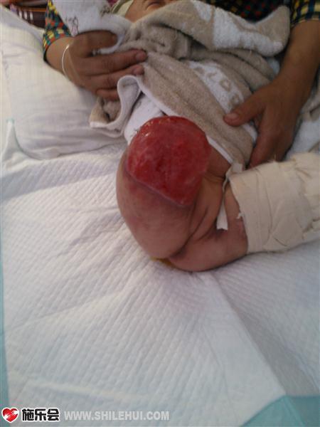 ����Ƥ���󣬱���������һֱ��������ӣ������˽��������£�