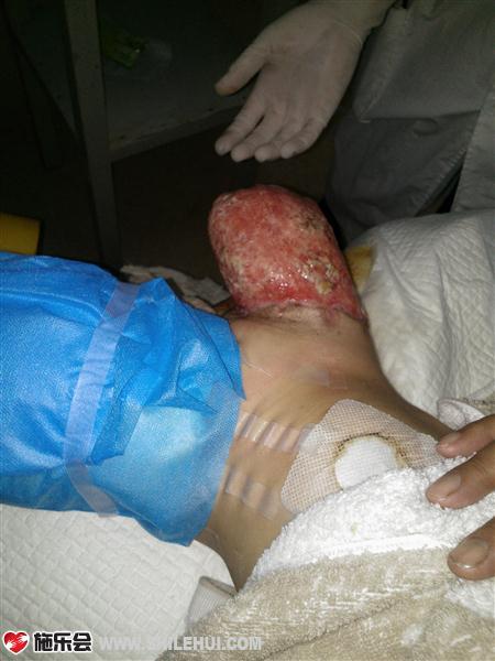 ��Ϊ�����ڻ�ҩ�����е�ƿ������Ҳ����������õ�ҩ�ͨ�����һЩ�����£������á�