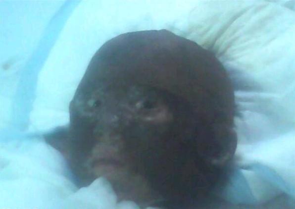 ������ҽԺICU�����ң�ȫ������ɴ���������Ѿ�����Ŀȫ����