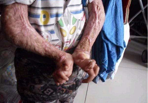 ˫�ּ��첲�������ˣ����ܻ���������Է���ˮ�����С�