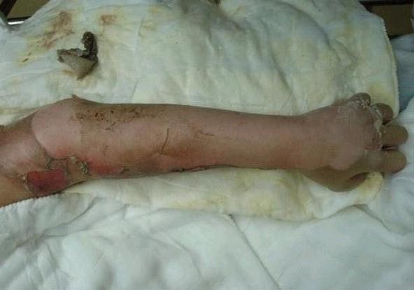 �����ֱ��Ѿ����������ˣ���Ҫ����ֲƤ����