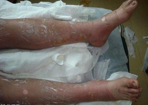 �������˺��˫�ȼ��両�ף��������ܻ�������